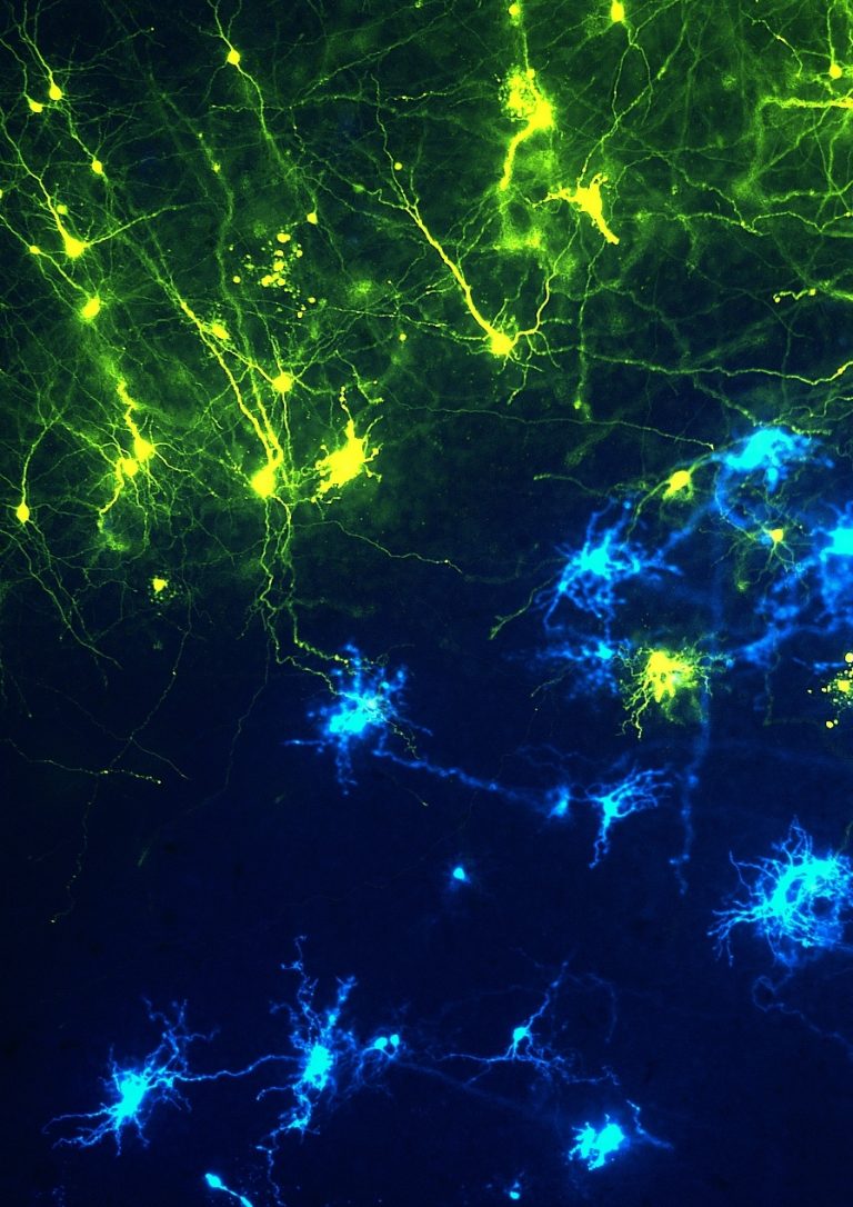 Lo Yellow And Blue Brain Slice
